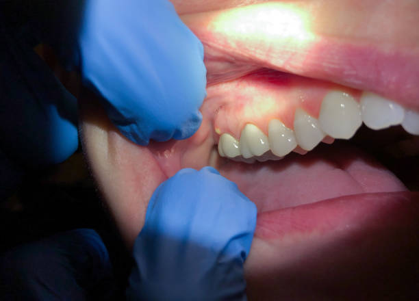 Emergency Dentist Open Today in GA